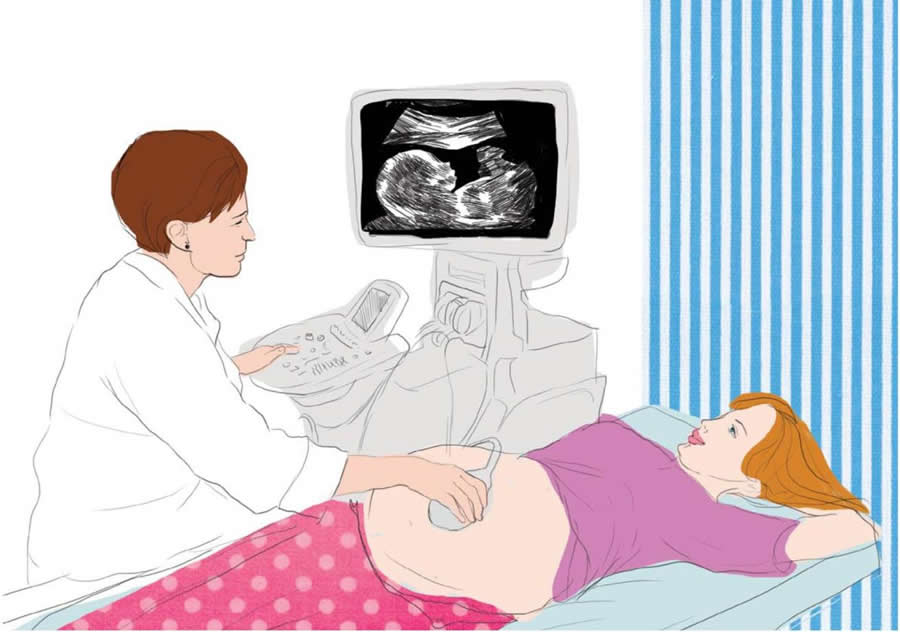 Kreslený obrázok lekárky vyšetrujúcej ležiacu ženu prostredníctvom ultrazvuku brucha
